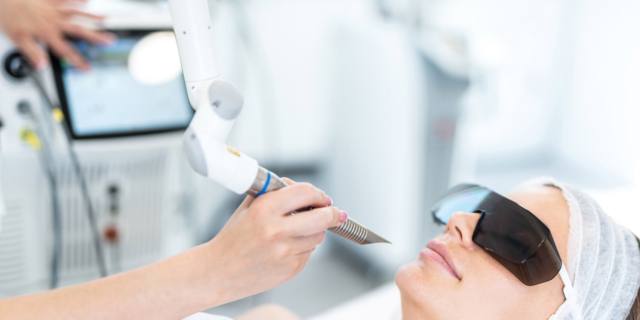 Come funziona il laser per l’acne?
