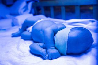 Newborn having a treatment for jaundice under ultraviolet light, Baby has high level of bilirubin, laying under blue light to reduce jaundice level. Safe medical procedures