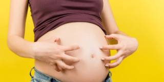 donna con prurito in gravidanza