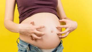 donna con prurito in gravidanza