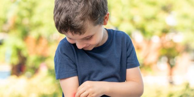 Estate, anche per i bimbi è tempo di allergie?