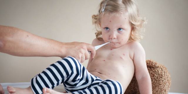 Quinta malattia: contagio, sintomi e cura