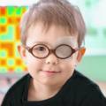 Bambino con occhio pigro ha occhiali e occhio bendato