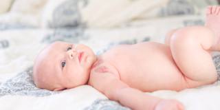 Alcuni neonati nascono con un angioma a causa di una mlaformazione nel processo di angiogenesi