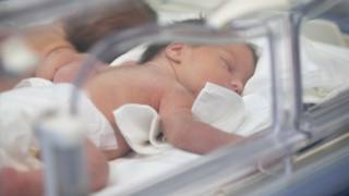 I neonati prenaturi hanno bisogno di cure speciali per lungo tempo