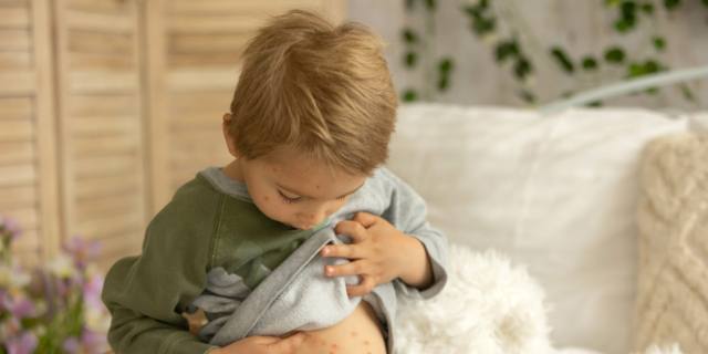 Casi di scarlattina in aumento tra i bambini: cosa fare?