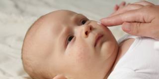 Dermatite atopica bambini: cause e cure della malattia infiammatoria della pelle