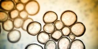 Ureaplasma: cos’è, sintomi e come si trasmette. L’esperto chiarisce i dubbi delle future mamme
