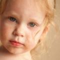 La pelle del bambino dopo l'estate può andare incontro a una serie di disturbi legati alla prolungata esposzione al sole. Ecco come intervenire in modo corretto