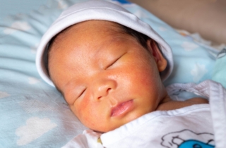 Ittero neonatale