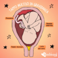 tappo mucoso