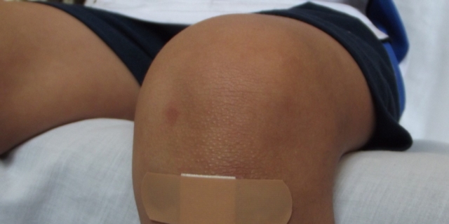 Sbucciature, piccole ferite e traumi: come soccorrere i bambini