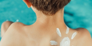 Arrossamenti e scottature bambini: cosa fare?