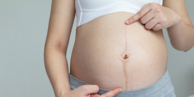 Linea nigra in gravidanza: quando compare e a cosa serve la riga scura sul pancione