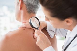 melanoma negli uomini melanoma negli uomini