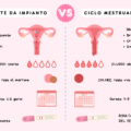 Un'immagine infografica sulle differenza tra perdite da impianto e ciclo mestruale