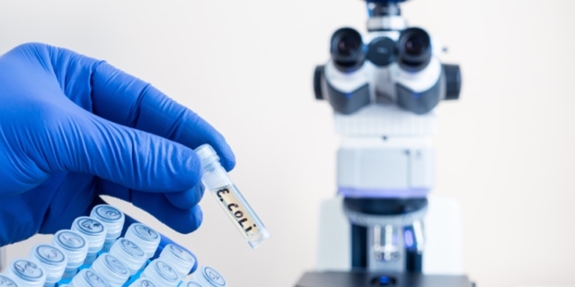 Escherichia coli: sintomi, come si prende e le conseguenze più estreme