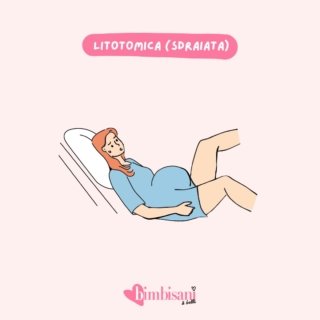 Posizione parto litotomica sdraiata