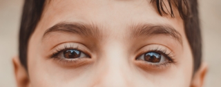 Congiuntivite nei bambini: quanto dura, sintomi e rimedi