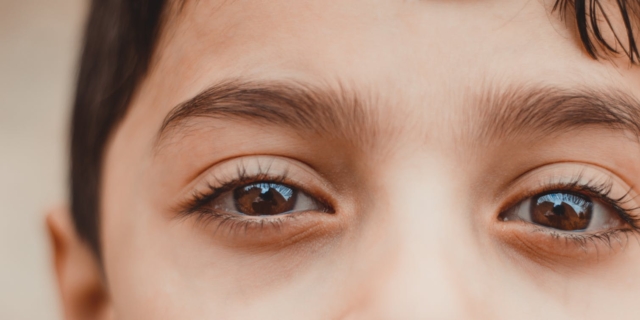 Congiuntivite nei bambini: quanto dura, sintomi e rimedi