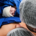 Emorragia post partum