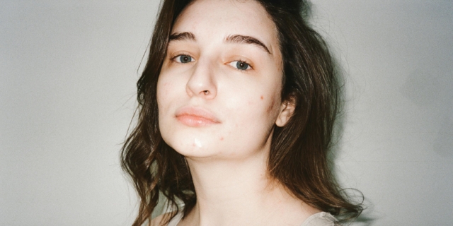 Acne in gravidanza: quando compare, rimedi e prodotti utili