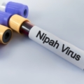 Virus Nipah