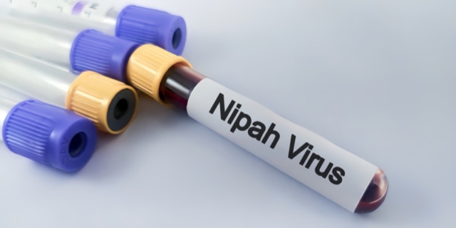 Allarme virus Nipah dall’India: ci sono rischi in Italia? Il parere del virologo Pregliasco