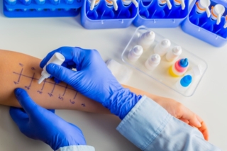 Prick test per prove allergiche