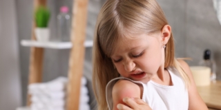 Puntura di tafano: come riconoscerla e come curarla nei bambini